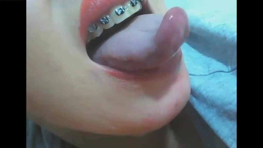 Mouth fetish braces